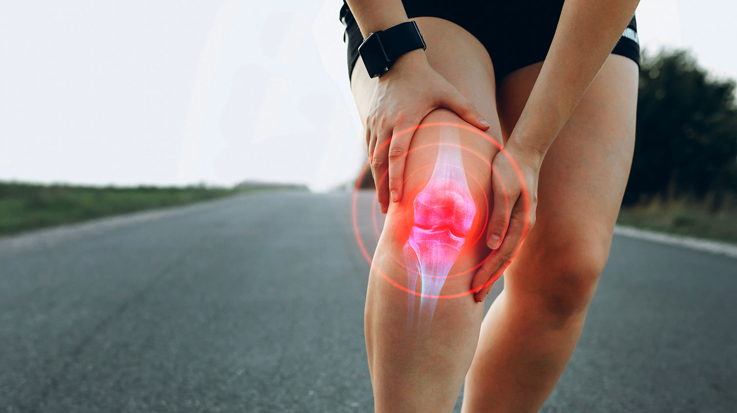 Gelenkschmerzen? Erst mal Gel oder Pflaster Schmerzgel Arthrose
