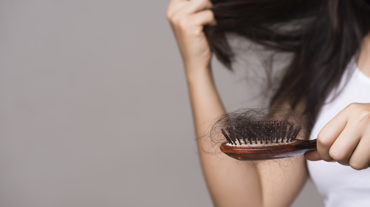 Haarausfall stoppen – die besten Mittel Haarausfall stoppen - die besten Mittel